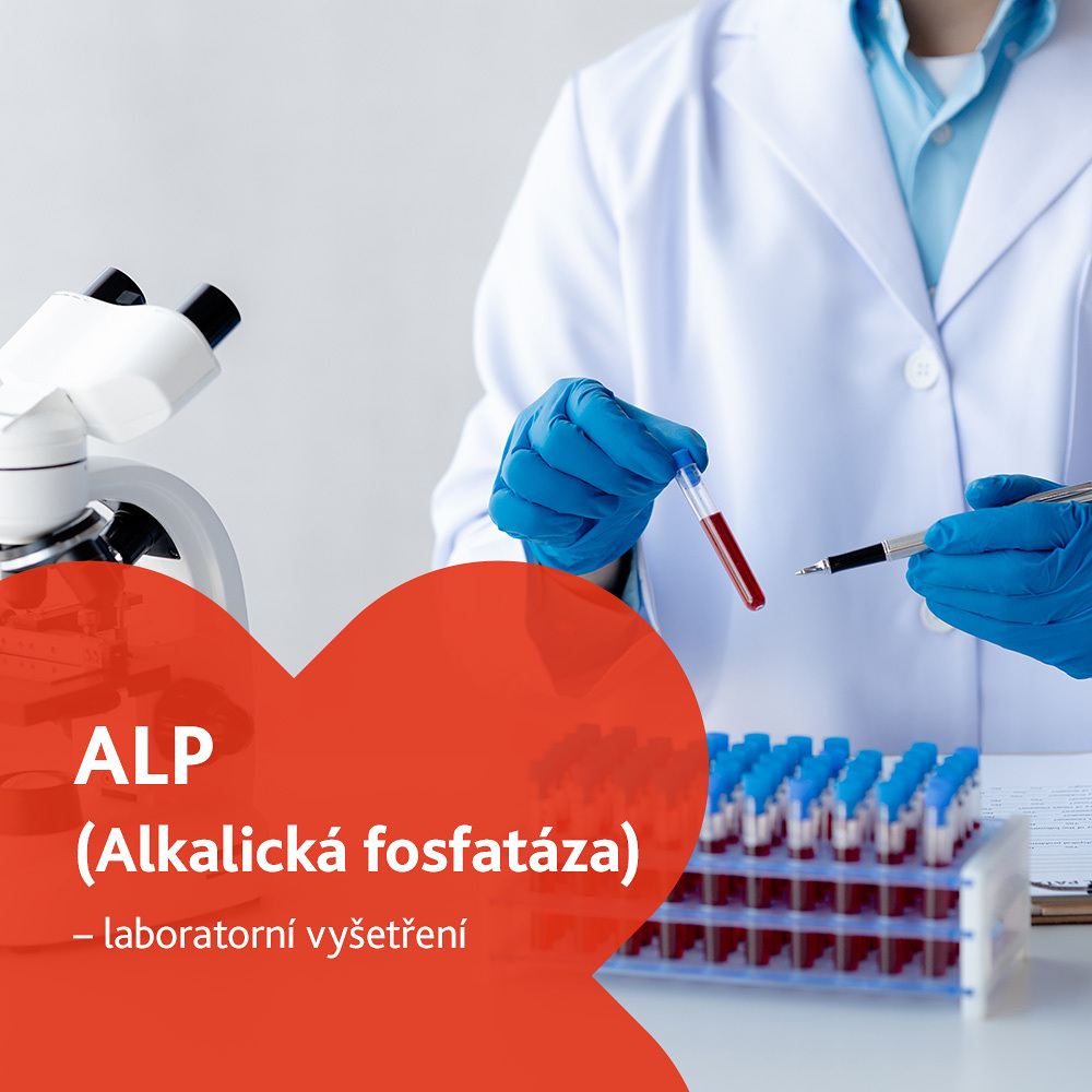 Alkalická fosfatáza (ALP) - laboratorní vyšetření