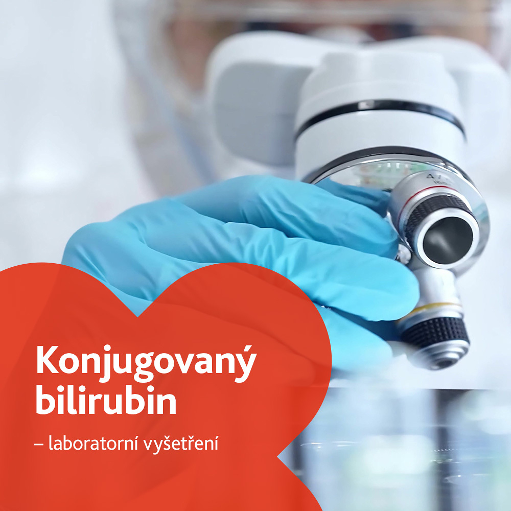 Konjugovaný bilirubin - laboratorní vyšetření