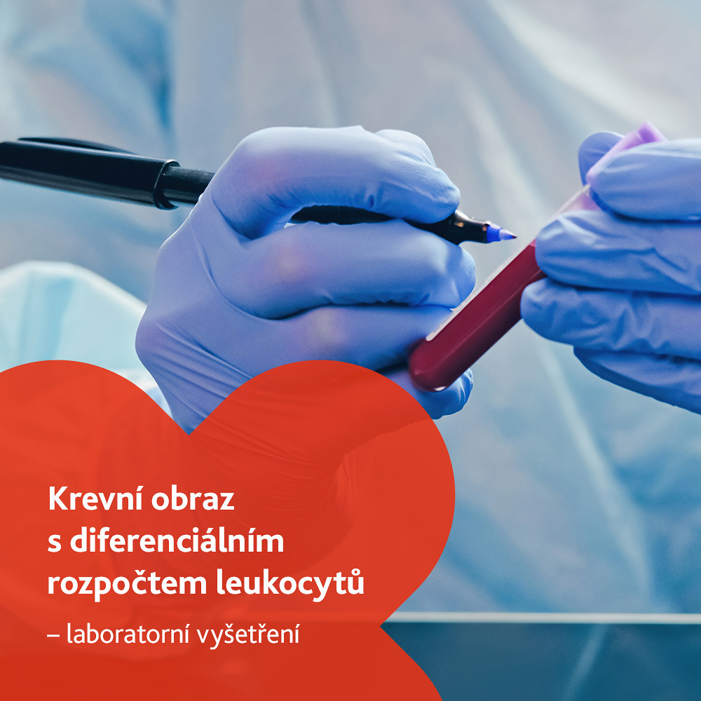 Krevní obraz s diferenciálním rozpočtem leukocytů - laboratorní vyšetření