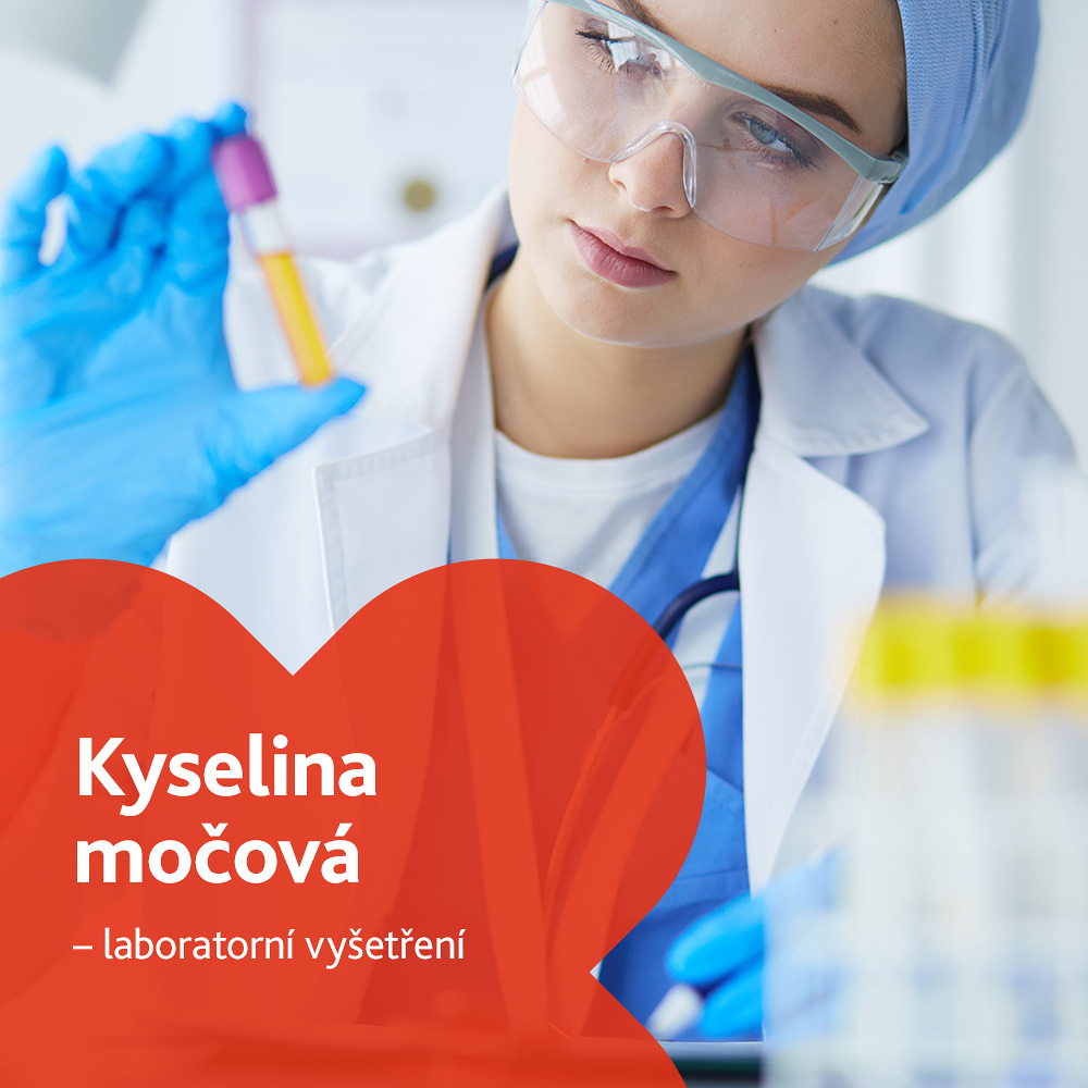 Kyselina močová - laboratorní vyšetření