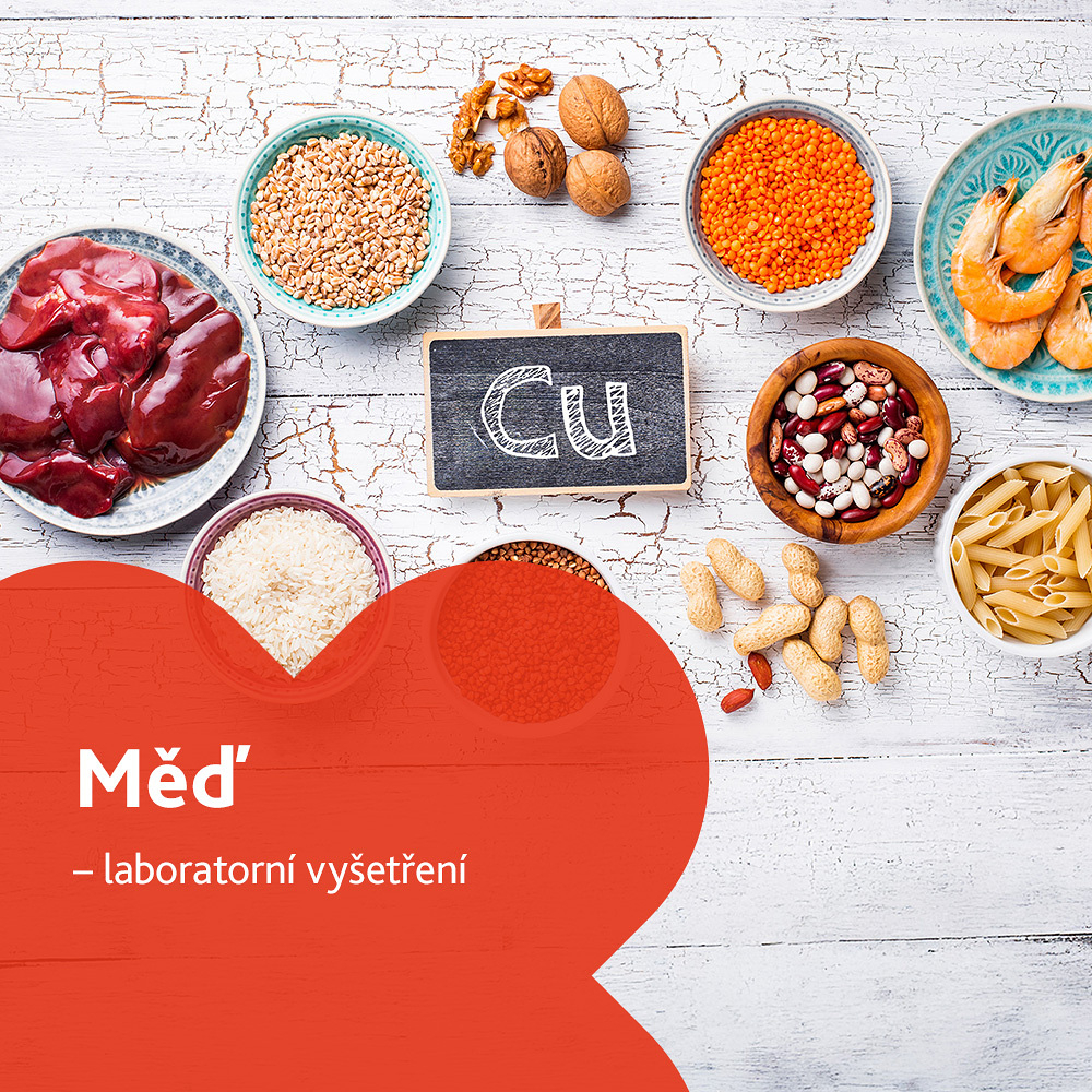 Měď - laboratorní vyšetření