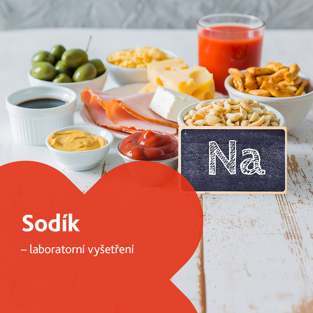 Sodík - laboratorní vyšetření