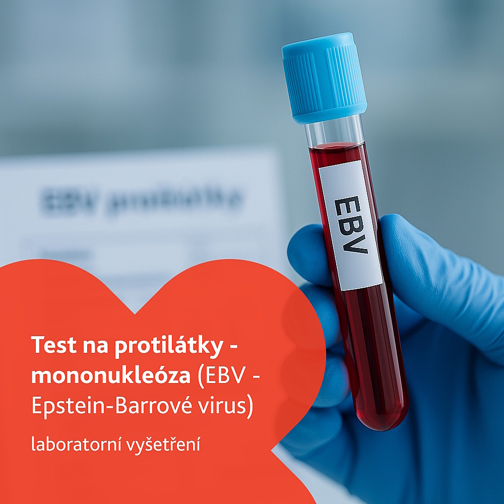 Test na protilátky - mononukleóza laboratorní vyšetření
