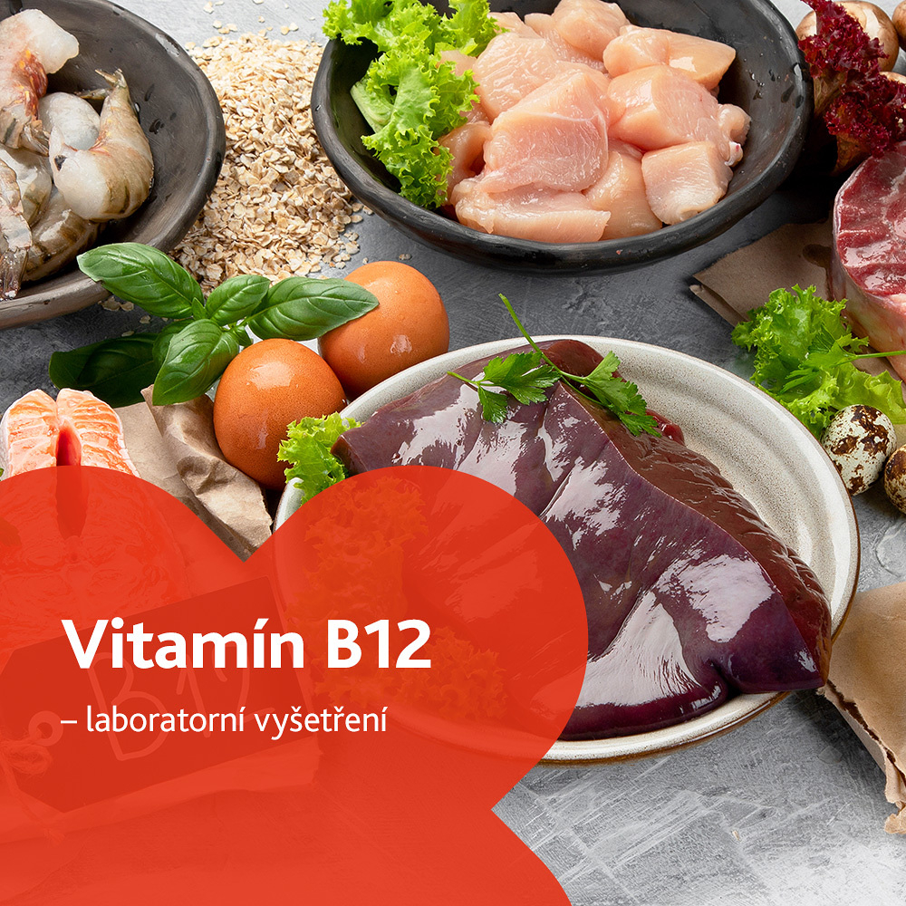 Vitamín B12 - laboratorní vyšetření