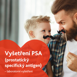 Vyšetření PSA (Prostatický specifický antigen) - laboratorní vyšetření